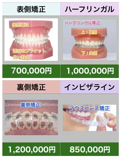 南千住小児歯科矯正歯科の料金表