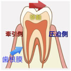 矯正のリスク、治療中の歯の動揺