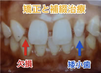 矯正治療と審美治療