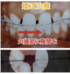 矯正治療と審美治療