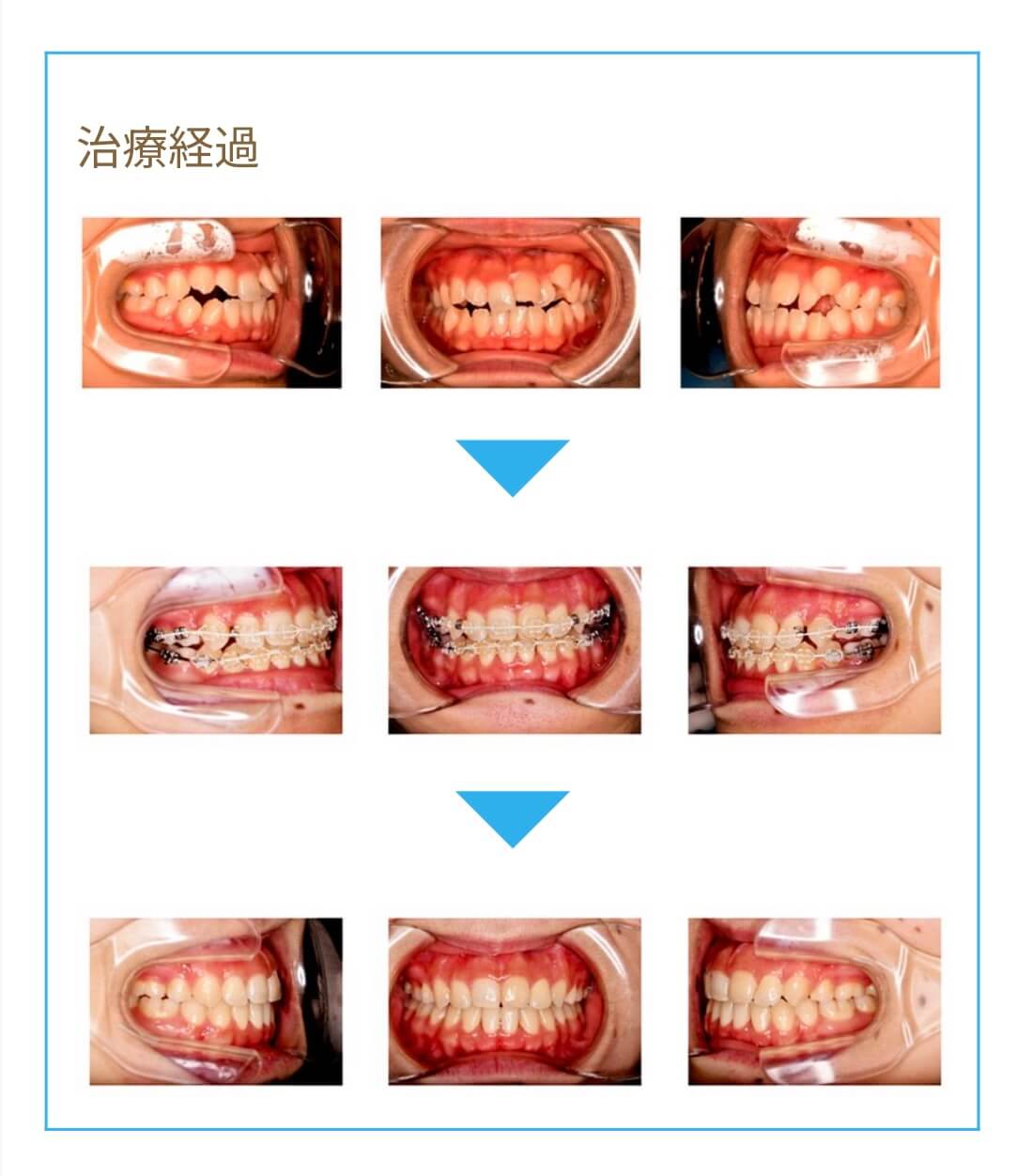 矯正歯科の選び方