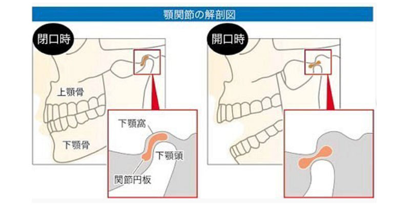 矯正治療の免責事項