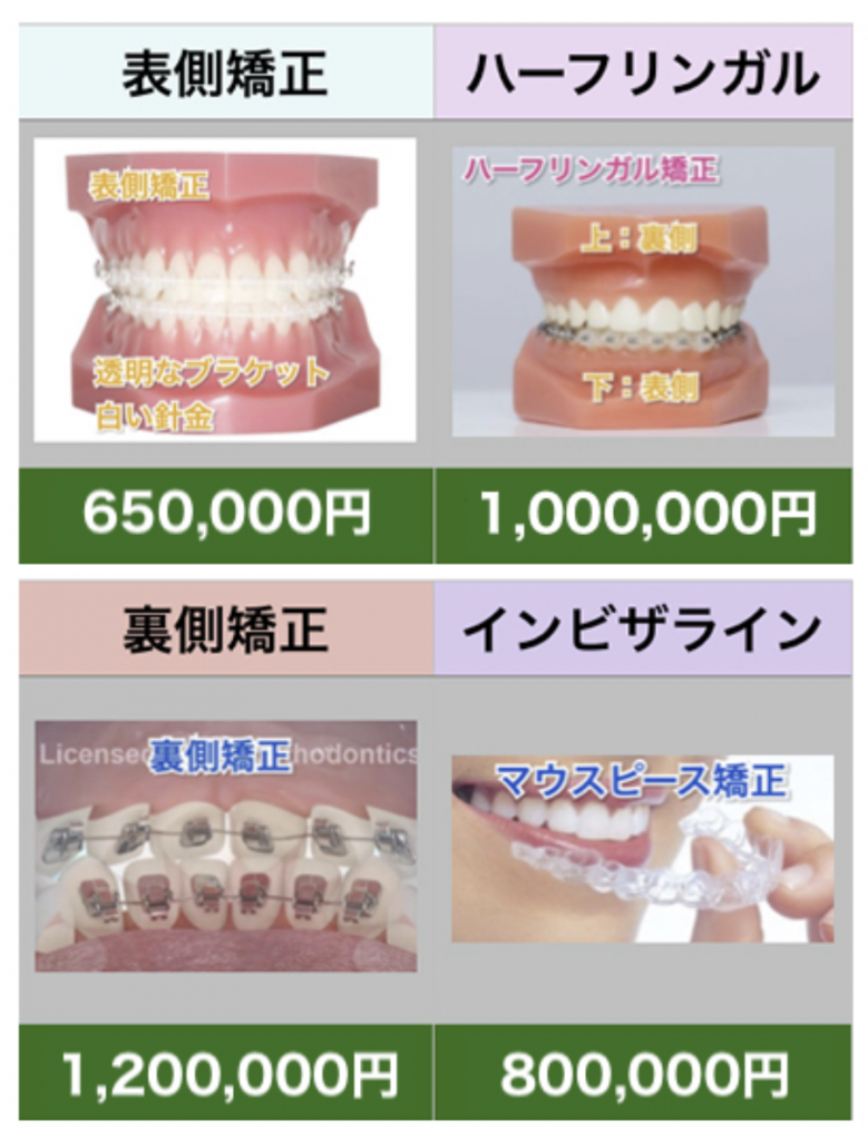 マウスピース矯正の治療費は高い 南千住の矯正歯科 南千住小児歯科矯正歯科 土日診療 南千住の矯正歯科専門医院 南千住小児歯科矯正歯科 マウスピース矯正の治療費は高い 南千住の矯正歯科 南千住小児歯科矯正歯科 土日診療 南千住の矯正歯科専門医院 南千住小児歯科矯正歯科